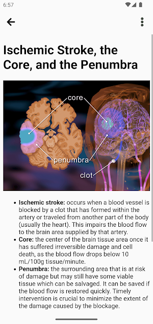 Stroke Management Screenshot 3