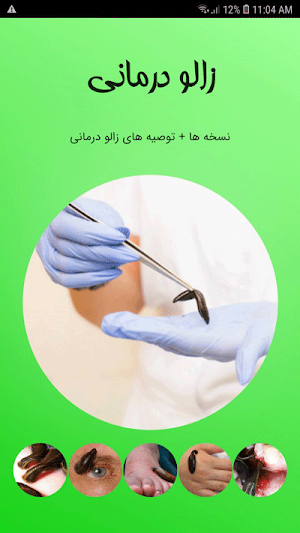 زالو درمانی Screenshot 0