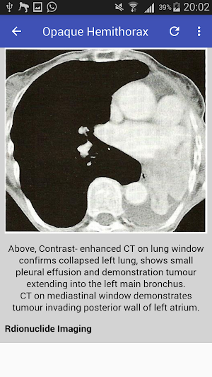 Clinical Chest Radiology Screenshot 0