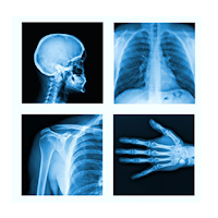 X-ray Body Scanner Camera Sim