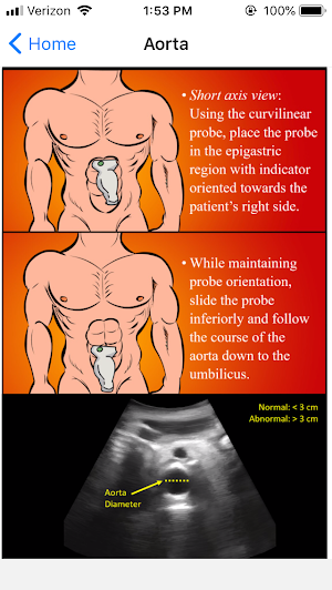 EM Ultrasound Screenshot 2