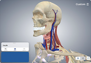 3D Cervical Dystonia Screenshot 1