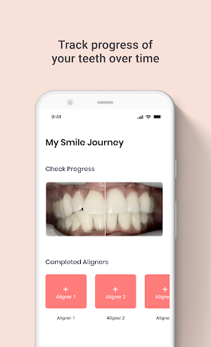 Snazzy: Aligner Monitoring Screenshot 2