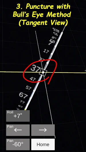 AR Puncture: Medical AR Viewer Screenshot 3