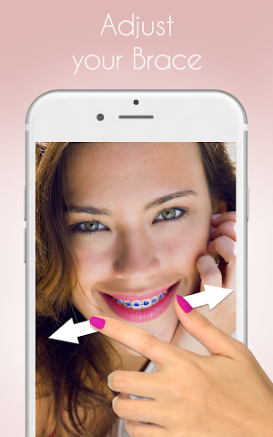Braces Photo Editor Screenshot 1