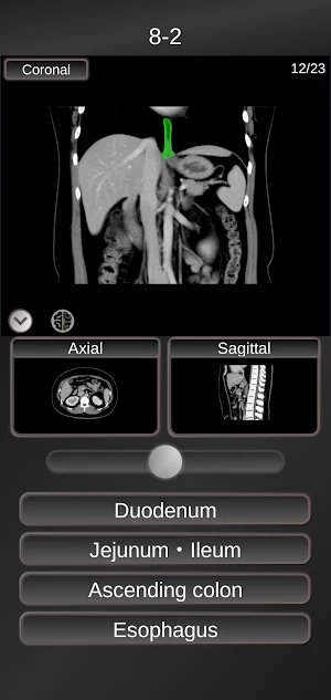 CT PassQuiz Abdomen / sectional anatomy / MRI Screenshot 2