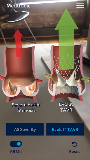 AS TAVR Education Screenshot 0