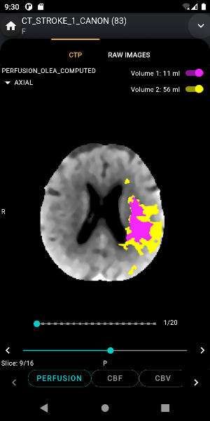 S.I.A Neurovascular Care Screenshot 2