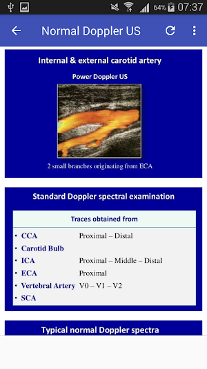 Doppler US Of Carotid arteries Screenshot 3