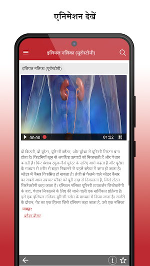 MSD मैनुअल उपभोक्ता संस्करण Screenshot 2
