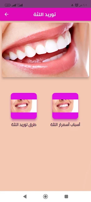 توريد اللثة Screenshot 2