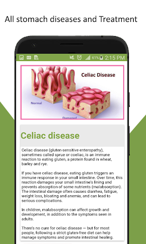 All Stomach Diseases and Treatment Screenshot 2