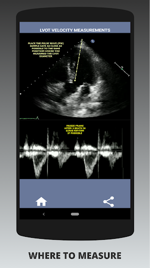 AORTIC STENOSIS PROTOCOL GUIDE Screenshot 1