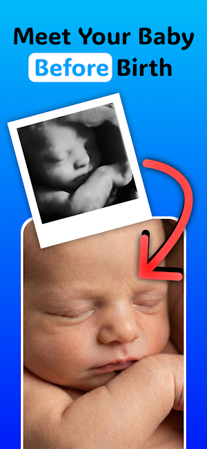 Ultrasound to Photo: BabyGuess Screenshot 0