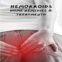 Hemorrhoid Remedy & Treatment