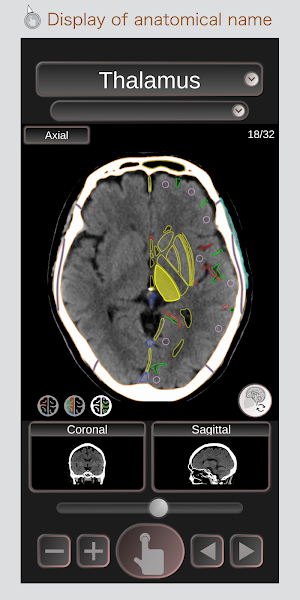 CT Passport Head/Brain / sectional anatomy / MRI Screenshot 0