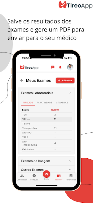 TireoApp Screenshot 2