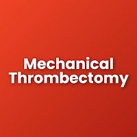 Thrombectomy