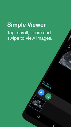BBR X-rays Screenshot 1