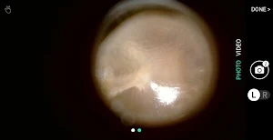 hearScope Screenshot 1