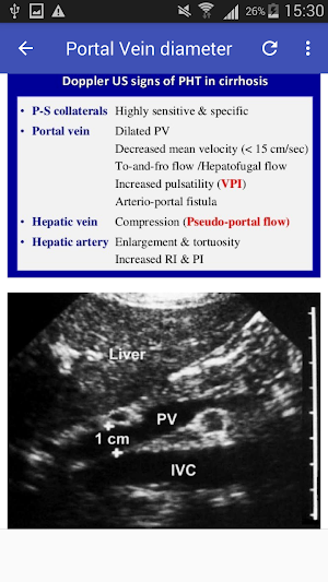 Portal hypertension Screenshot 0