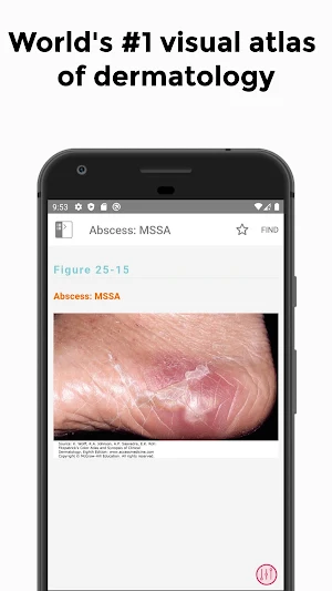 Fitzpatrick's Color Atlas & Syno of Clinical Derma Screenshot 1