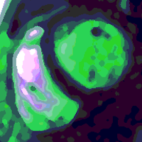 Cardiac MRI Guide