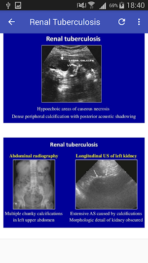 Ultrasound Urinary Tract Screenshot 3