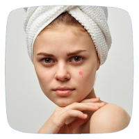 Toothpaste For Pimples Tips