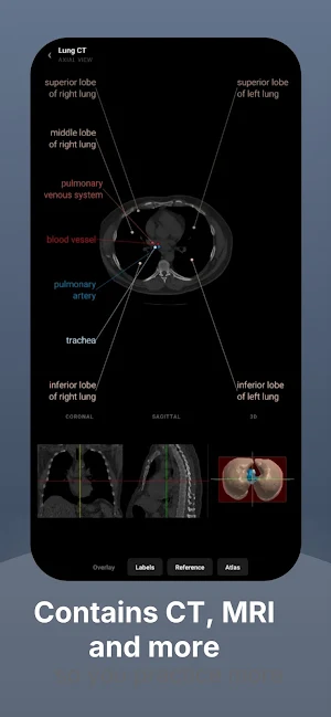 RadioAnatomy Screenshot 3
