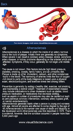 Heart Anatomy Pro. Screenshot 3