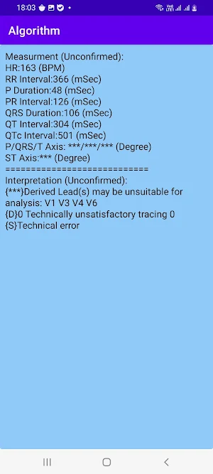 TCardio ECG Analyser Screenshot 3