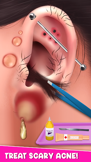 Piercing Game: Ear Wax removal Screenshot 0