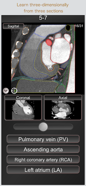 CT PassQuiz Heart / sectional anatomy / MRI Screenshot 2