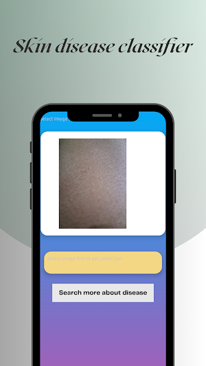 MyDerma Checker Screenshot 1