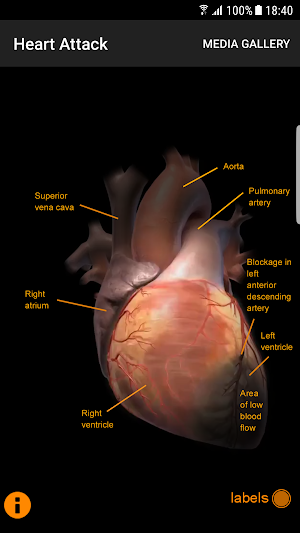 CardioSmart Heart Explorer Screenshot 3