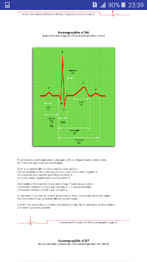 Interpreter un ECG Screenshot 2