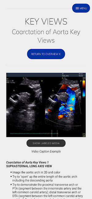 UK Congenital Echo Guide Screenshot 3