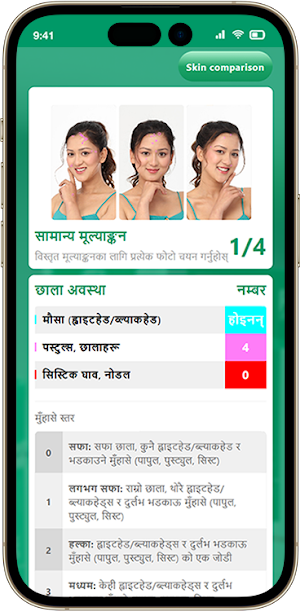 Acnes AI Detector (Ne) Screenshot 1