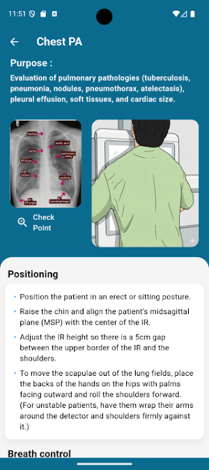 RadPosition: X-ray Positioning Screenshot 2