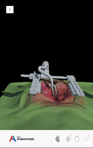 Youranastomosis Screenshot 2
