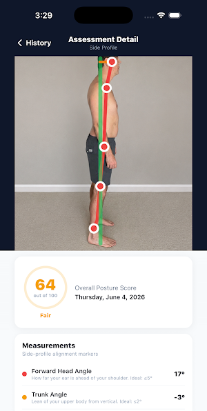 Posture Guy - Fix Your Posture Screenshot 1
