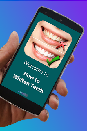 How to Whiten Teeth at home Fast Screenshot 0