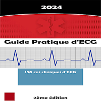 Guide d’ECG