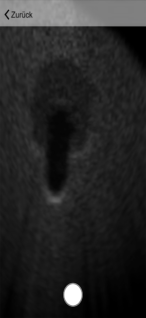 Ultraschall Screenshot 1