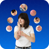All Skin diseases & treatment