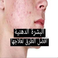 البشرة الدهنية وطرق لعلاجها