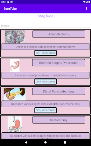 SurgTube Screenshot 2