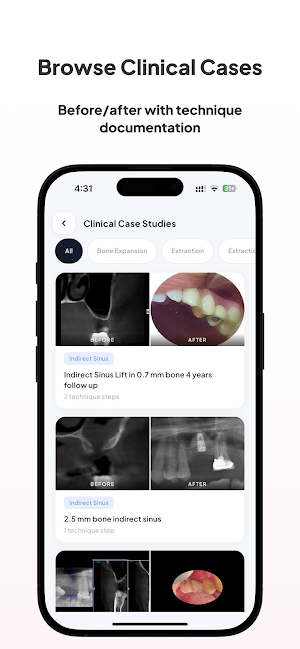 OSSEOSURE for Dentists Screenshot 1