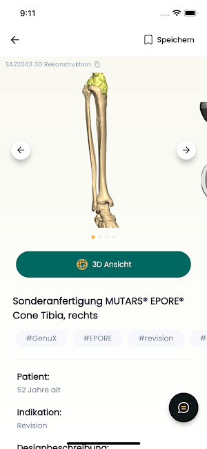 implantcast C-Fit 3D® Screenshot 2